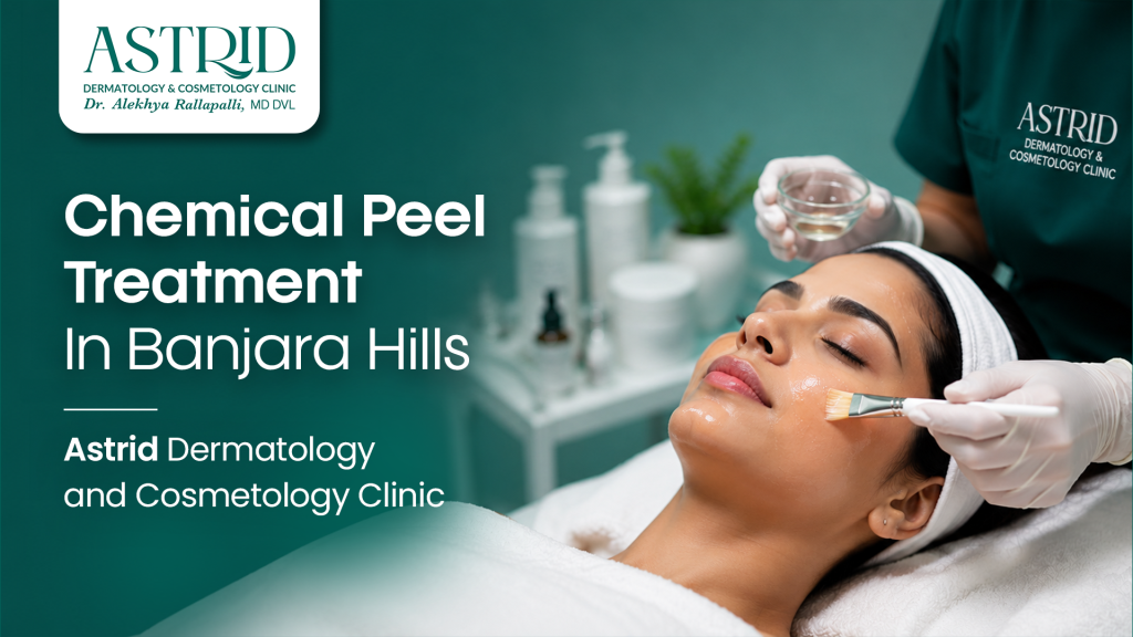 Chemical Peel Treatment In Banjara Hills