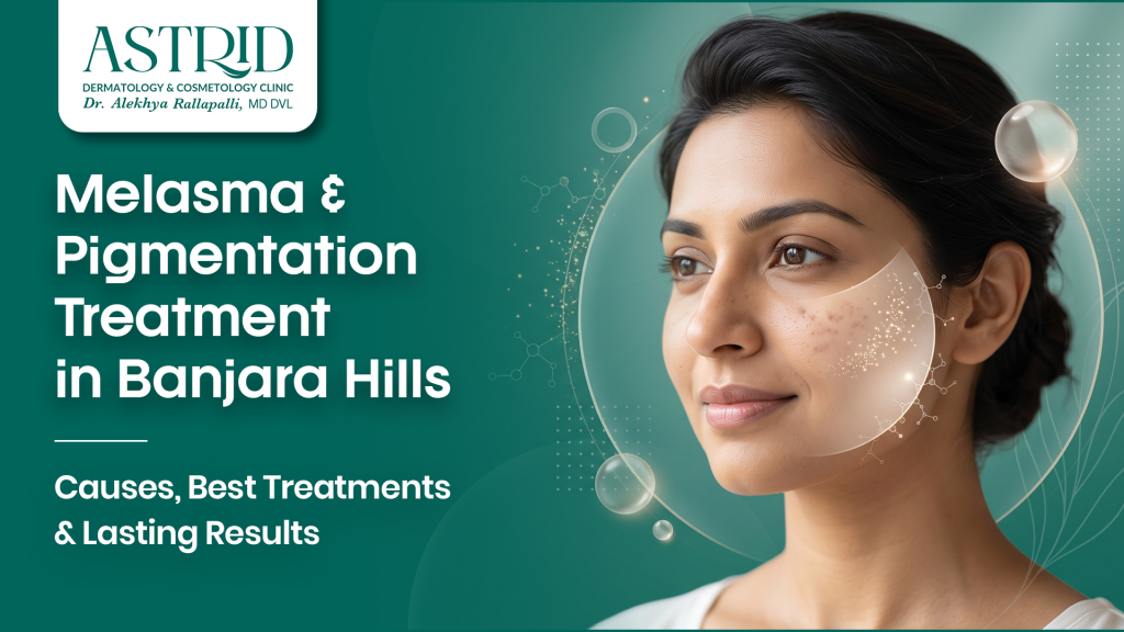 Melasma & Pigmentation Treatment in Banjara Hills – Causes, Best Treatments & Lasting Results