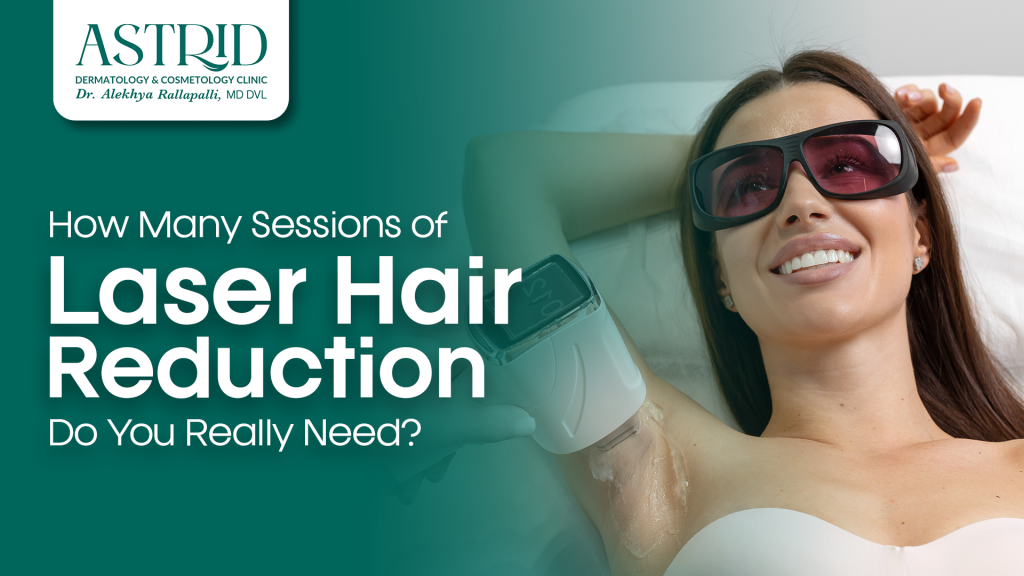 How Many Sessions of Laser Hair Reduction Do You Really Need?