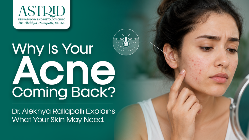 Why Is Your Acne Coming Back? Dr. Alekhya Rallapalli Explains What Your Skin May Need
