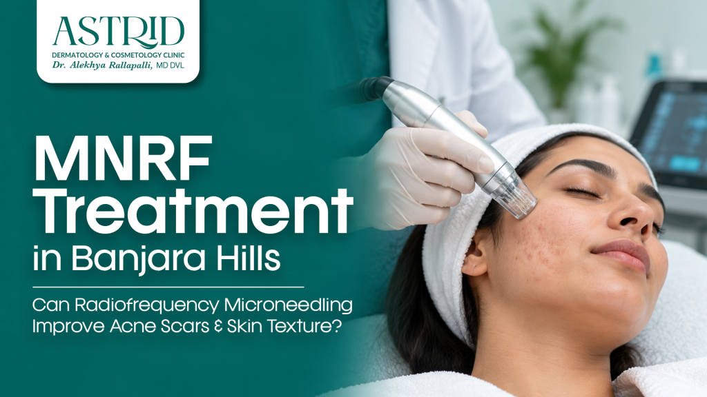 MNRF Treatment in Banjara Hills – Can Radiofrequency Microneedling Improve Acne Scars & Skin Texture?