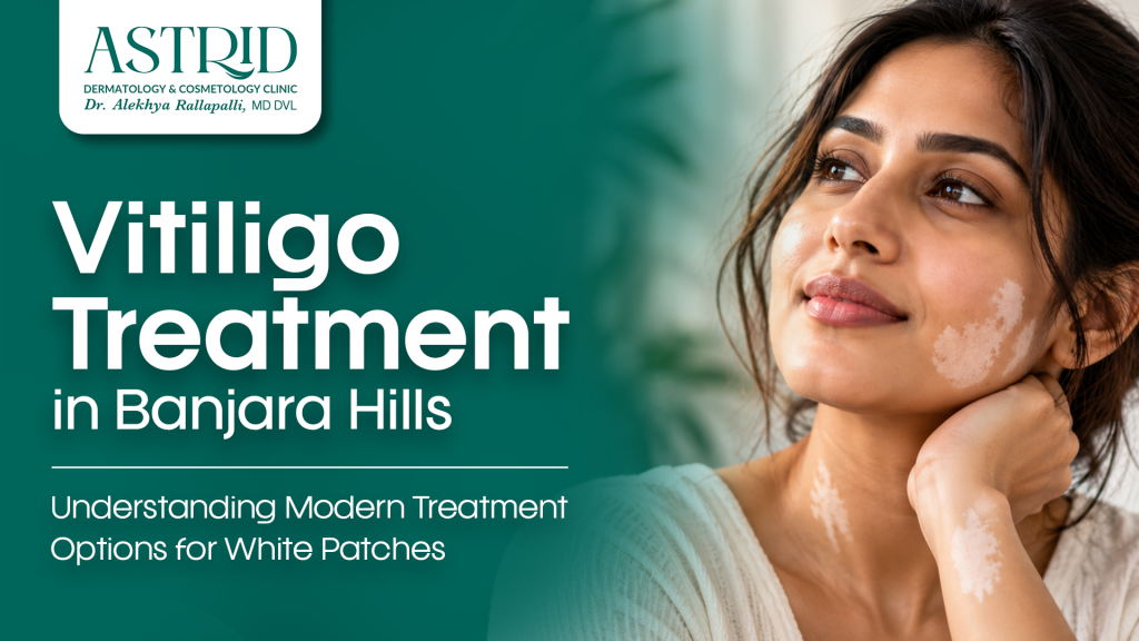 Vitiligo Treatment in Banjara Hills – Understanding Modern Treatment Options for White Patches