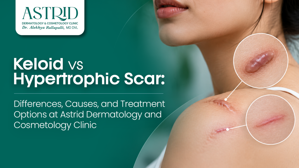 Keloid vs Hypertrophic Scar: Differences, Causes, and Treatment Options at Astrid Dermatology and Cosmetology Clinic