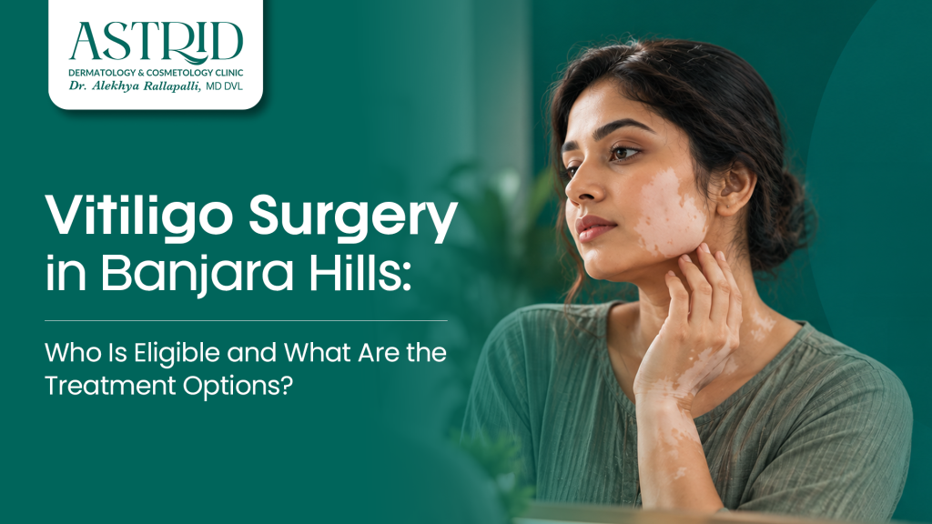 Vitiligo Surgery in Banjara Hills Who Is Eligible and What Are the Treatment Options